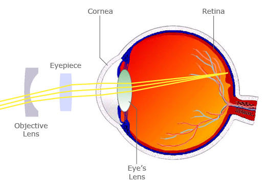 Figure 2: Viewfinder optics